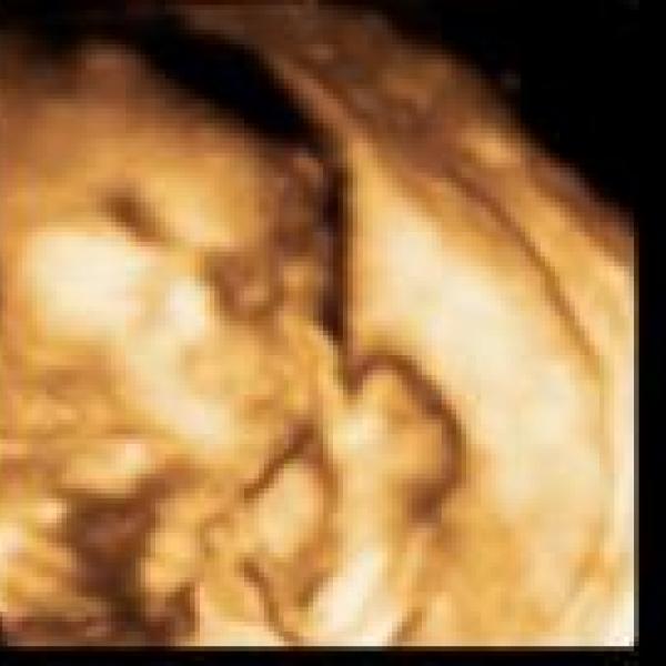 Tak sme vcera byli na 3D ultrazvuku a i tam nam potvrdili holcicku :)