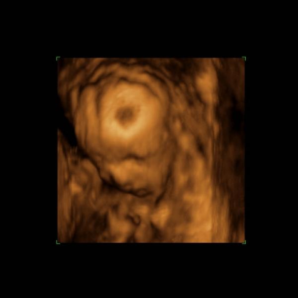 Naše mimi na 3D ultrazvuku
