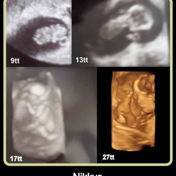 ultrazvuk prosincových miminek 2012