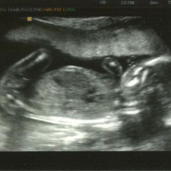 Bude to kluk :-) na Moje těhotenství.cz Bude to kluk :-)