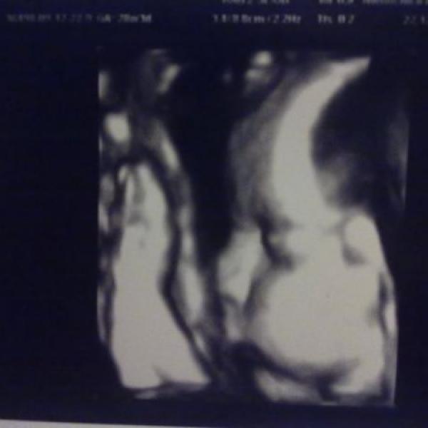 Už je to rok.. na Moje těhotenství.cz Už je to rok..