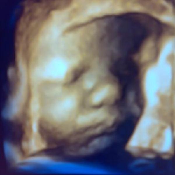 Už se to blíží:-) na Moje těhotenství.cz Už se to blíží:-)