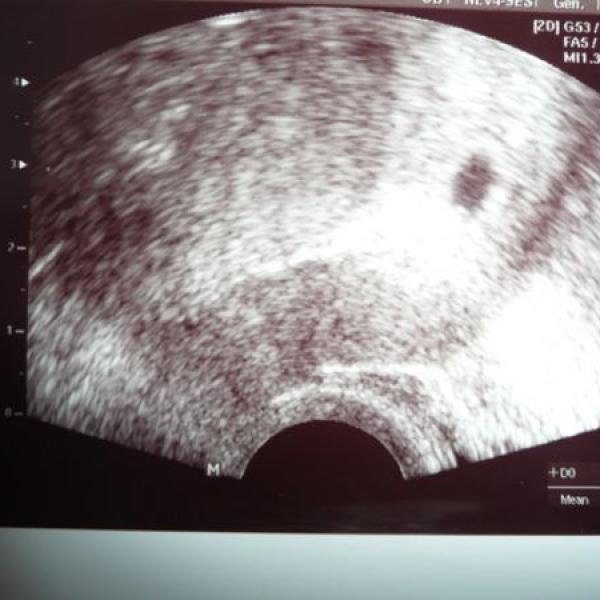 Druhé miminko bude v září 2010