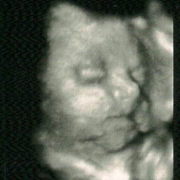 27+5tt na Moje těhotenství.cz 27+5tt