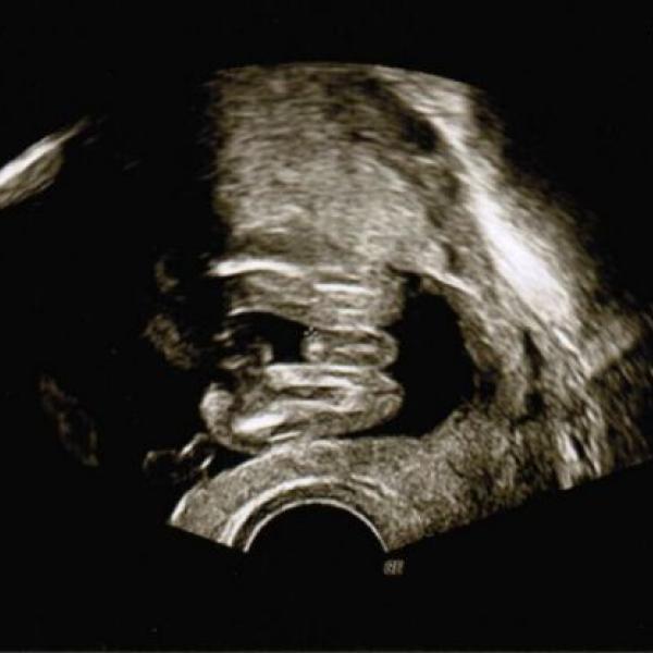 holky, je tam pindik? :)