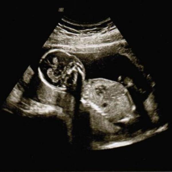 holky, je tam pindik? :)