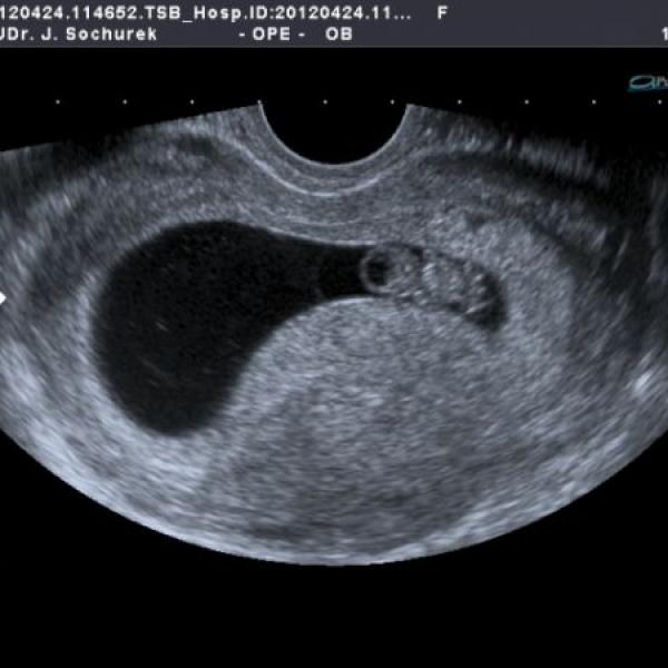 schoval se ve škvíře:)