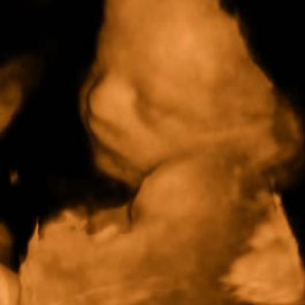 4D UTZ naše malá Sofinka:o))28+1tt