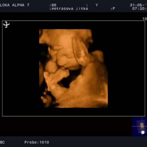 4D UTZ naše malá Sofinka:o))28+1tt