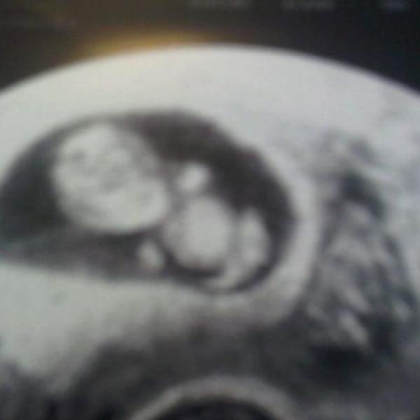 Nase mala Adelka :-) na Moje těhotenství.cz Nase mala Adelka :-)