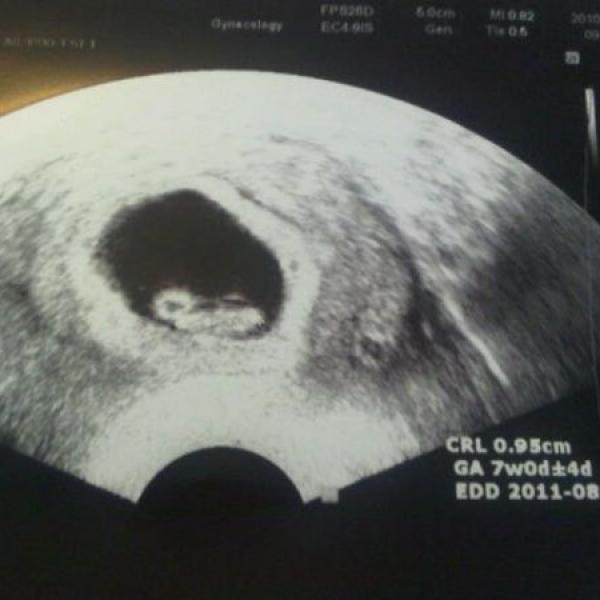 Nase mala Adelka :-) na Moje těhotenství.cz Nase mala Adelka :-)