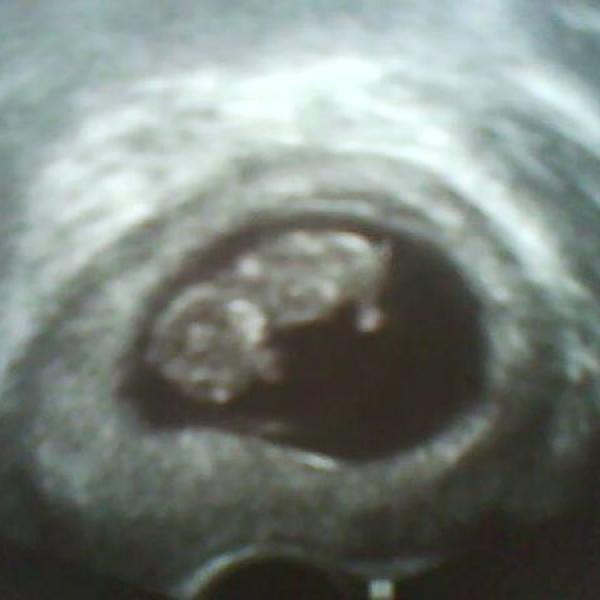 KO min. pátek + obrázek