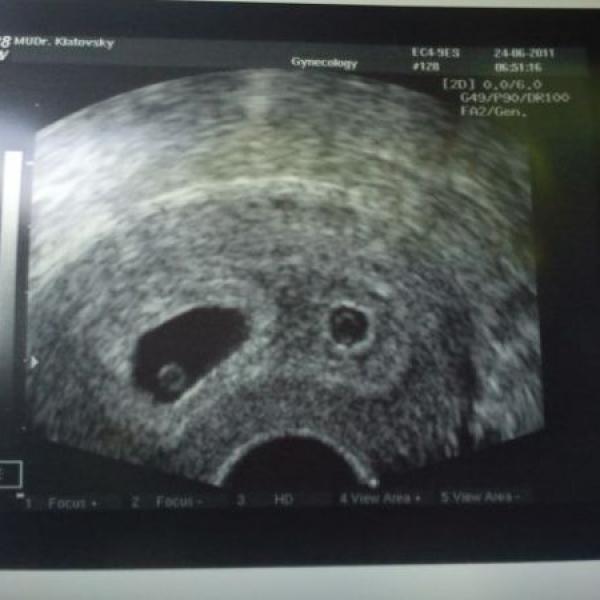 Nebojte se doktorů:-))