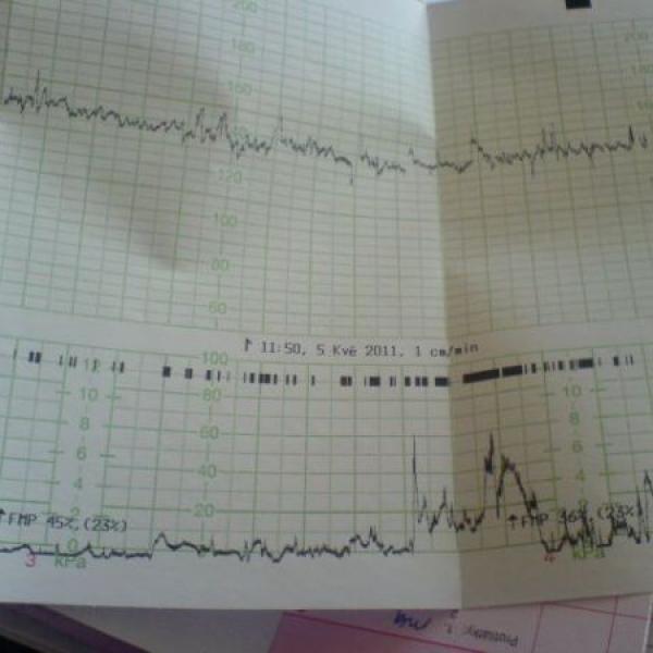 druhá kontrola v porodnici ve 38+0tt