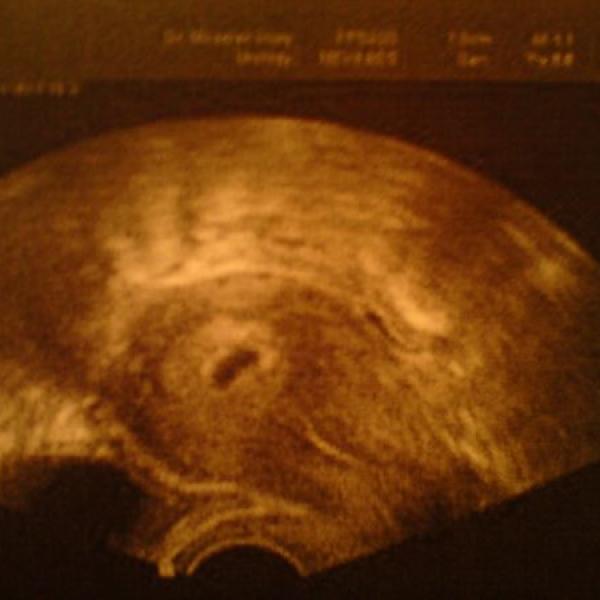 Těhulka po první ovulaci za 13 let.