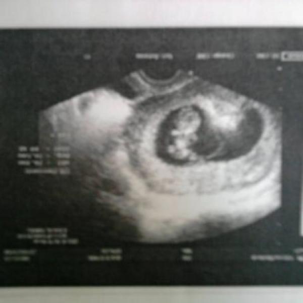 Fotečka na Moje těhotenství.cz Fotečka