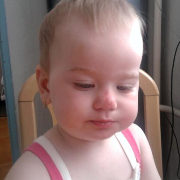 spadli jsme na nosíček :(