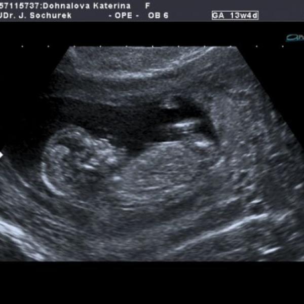 screening na jedničku:)