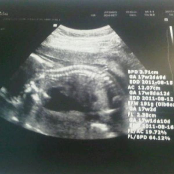 Tak zase nic :-) na Moje těhotenství.cz Tak zase nic :-)