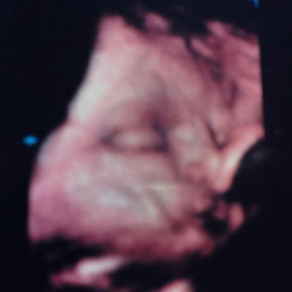 Kontrola 29tt, Anežka a dotazek...