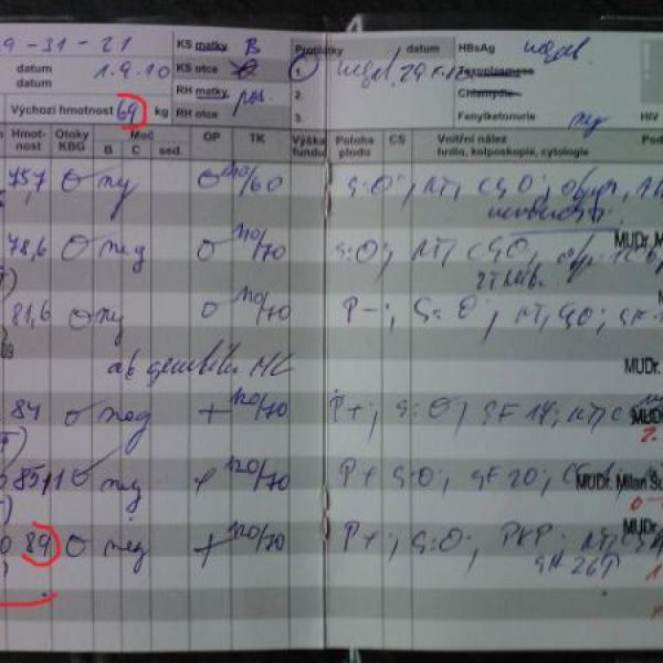 Pro spolutěhulky, co mi nevěřily ... 29tt na Moje těhotenství.cz Pro spolutěhulky, co mi nevěřily ... 29tt