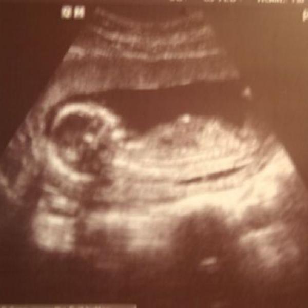 Kontrola v 16. týdnu