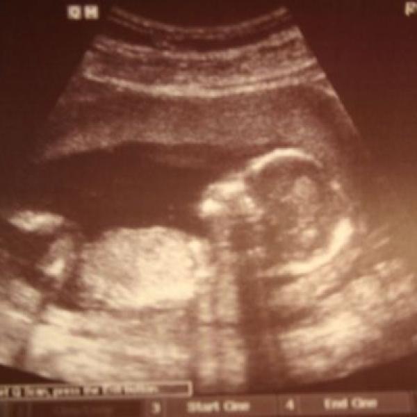 Kontrola v 16. týdnu