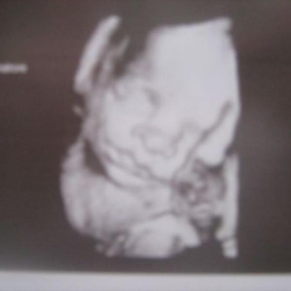 3d ultrazvuk a bříško