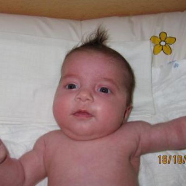 Nikloce budou v sobotu 3 měsíce, dnes kontrola u dr.