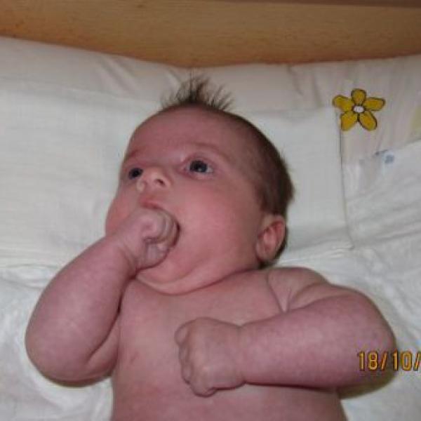 Nikloce budou v sobotu 3 měsíce, dnes kontrola u dr.