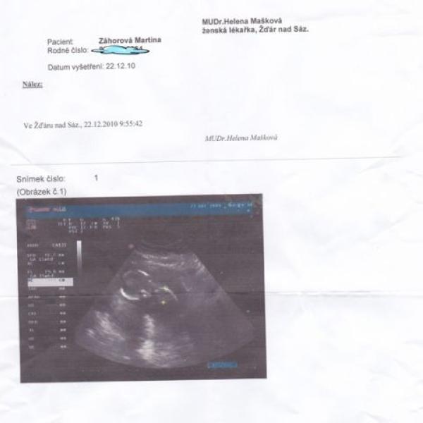 Naše druhé miminko :) na Moje těhotenství.cz Naše druhé miminko :)