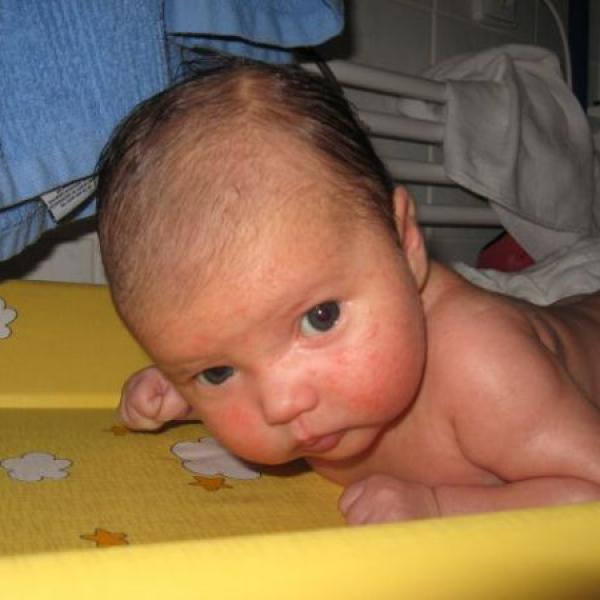 Poradna po šestinedělí