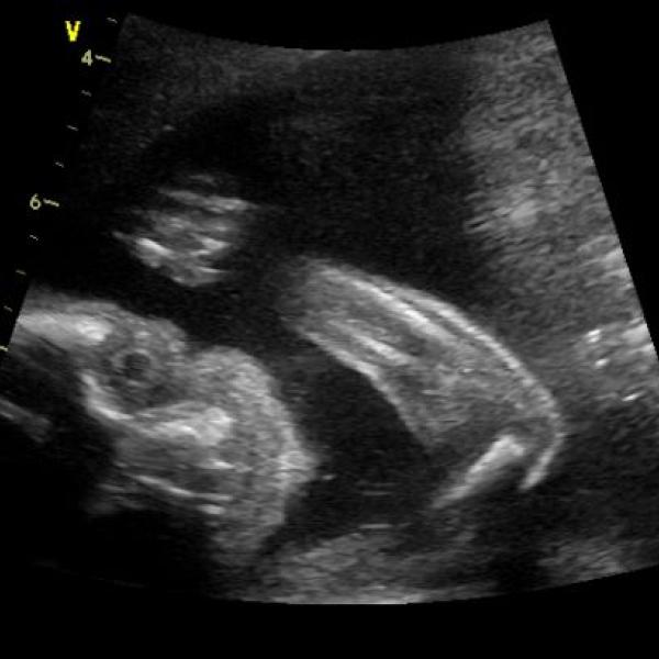 tak už i já vím co to bude na Moje těhotenství.cz tak už i já vím co to bude