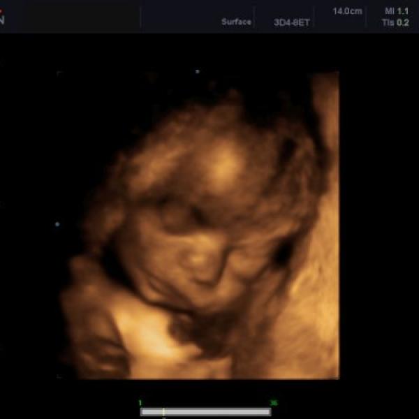 Poradna 25+6 + 3D UTZ aneb jak se z Emičky stal Martínek