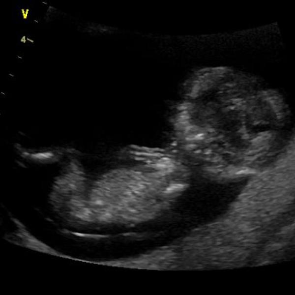 Včerejší screening