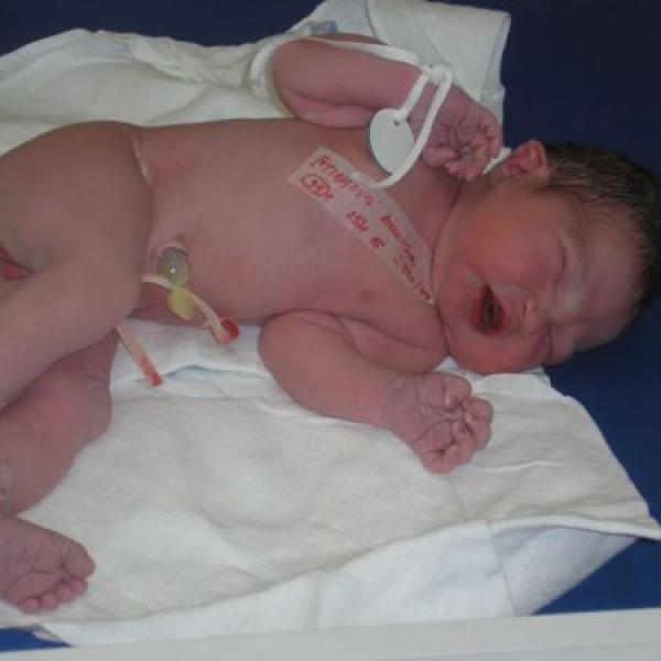 karolinka po narozeni