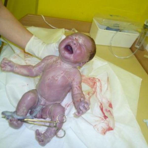 Už to mám za s sebou:-)