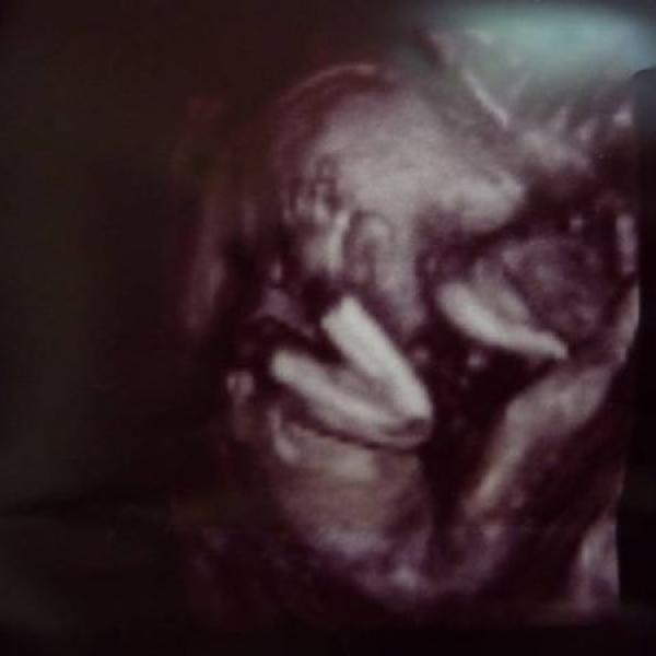 Náš velký ultrazvuk ve 21+0