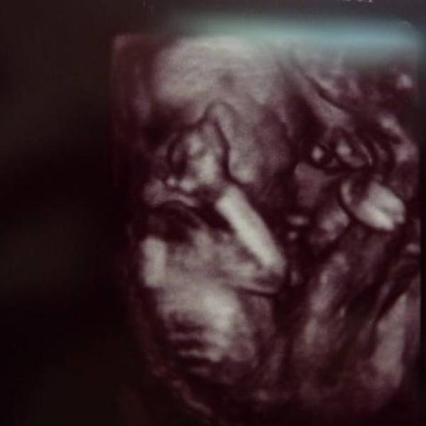 Náš velký ultrazvuk ve 21+0