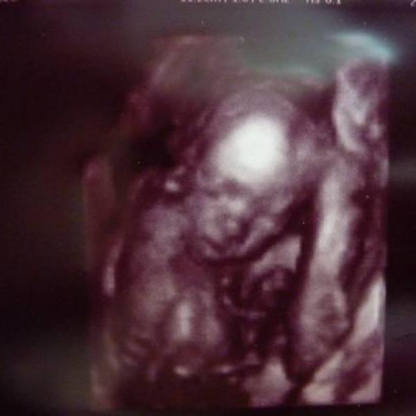 Náš velký ultrazvuk ve 21+0