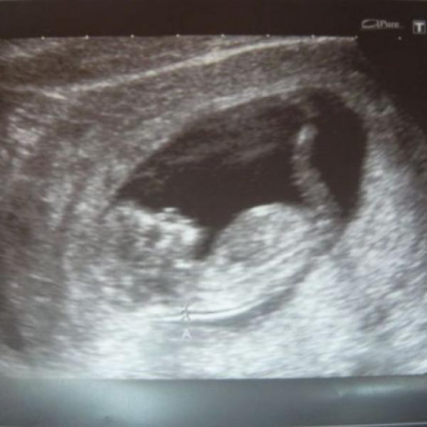 Tak jsem musela na pohotovost :-(