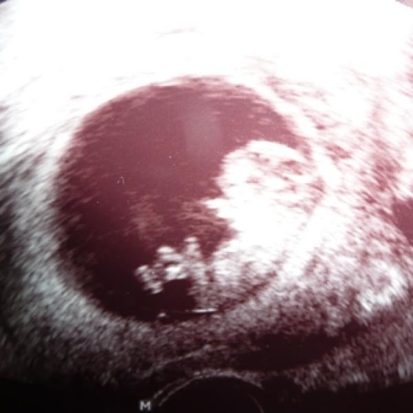 kontrola v 10+2...kdo jste na tom termínově stejně????