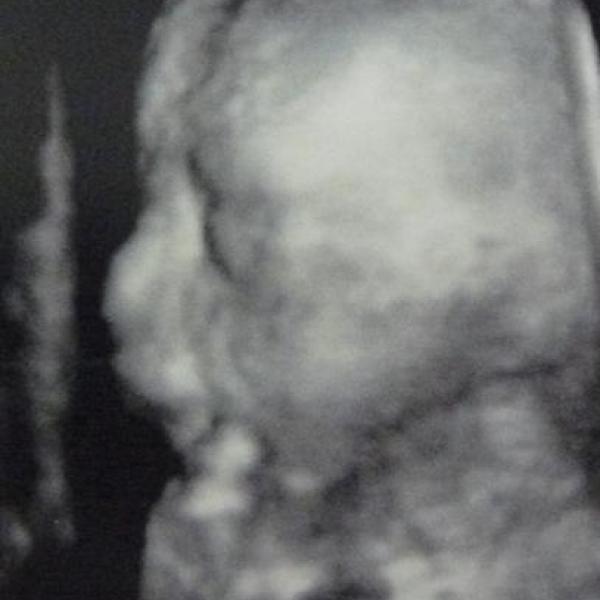 21+1 a asi holčička