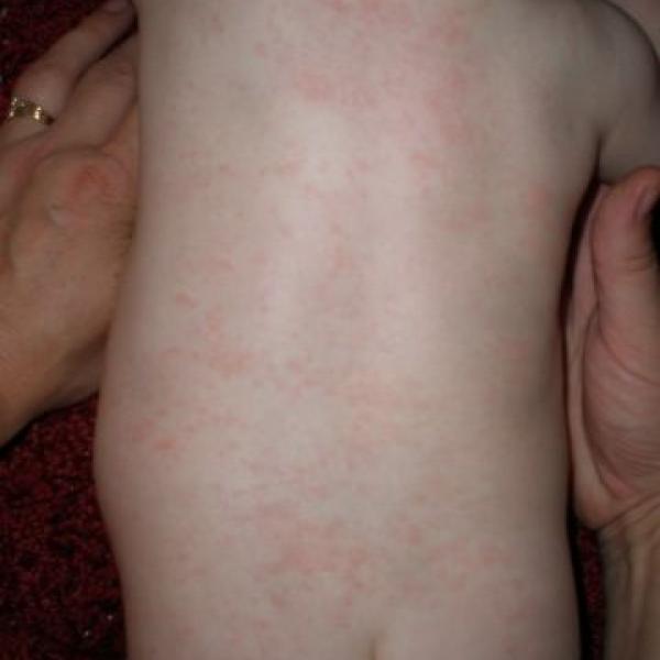 Takže maminky potničky nebo 6 nemoc ?? :)