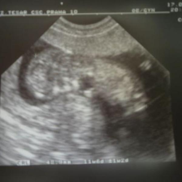Vcera ultrazvuk a vse je OK!!! :o)