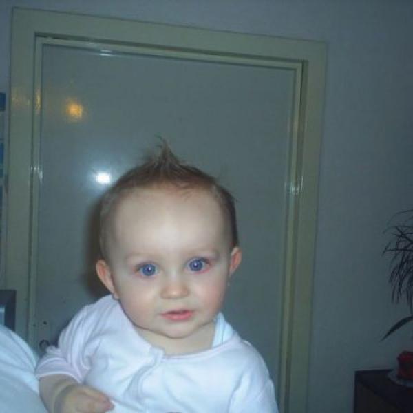 Prosím o radu-modré dásně u růstu zubů?