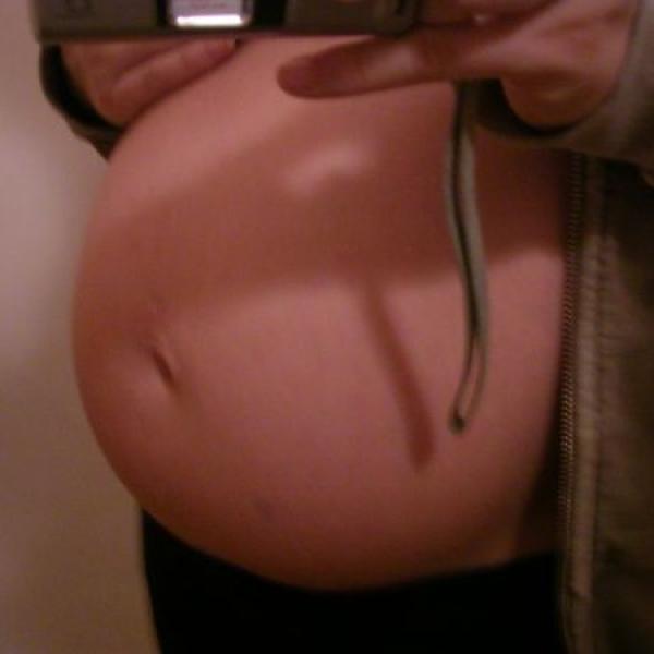 Pomooc, modřinka na břiše..