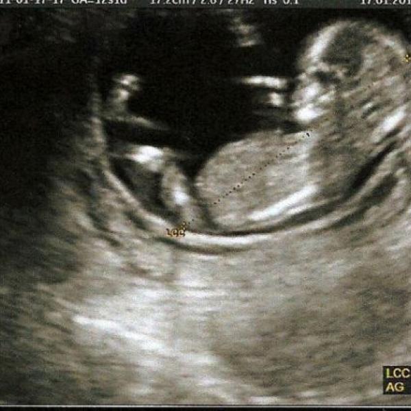 Nova budouci maminka srpnatka :-)