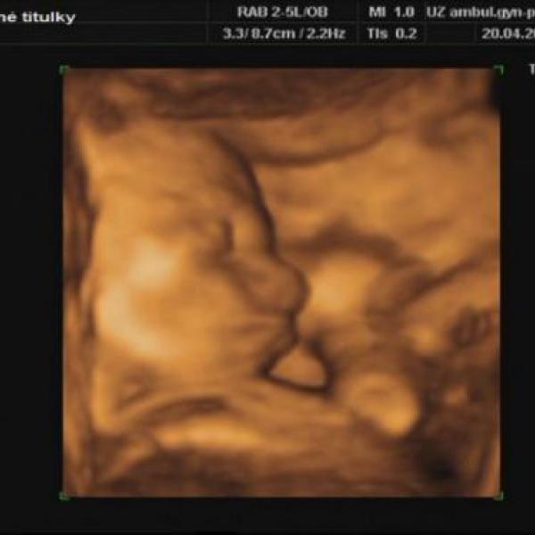 Návrat z poradny.... na Moje těhotenství.cz Návrat z poradny....