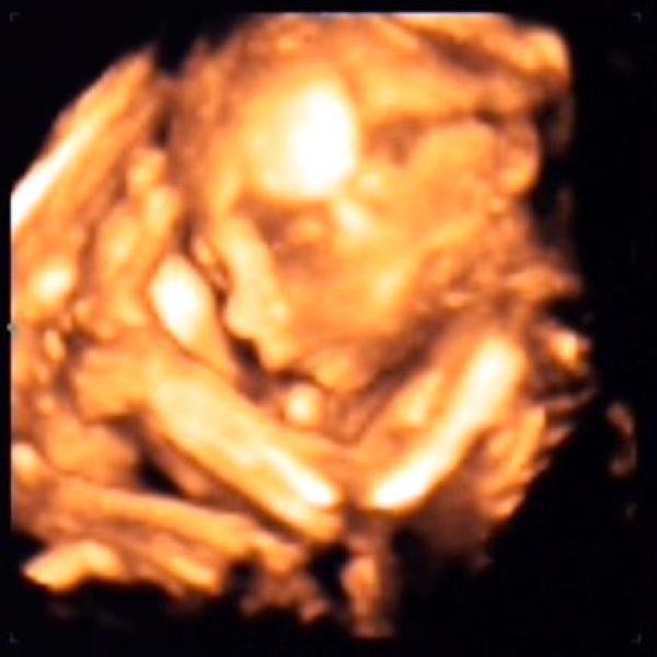 vzpomínka na první těhu